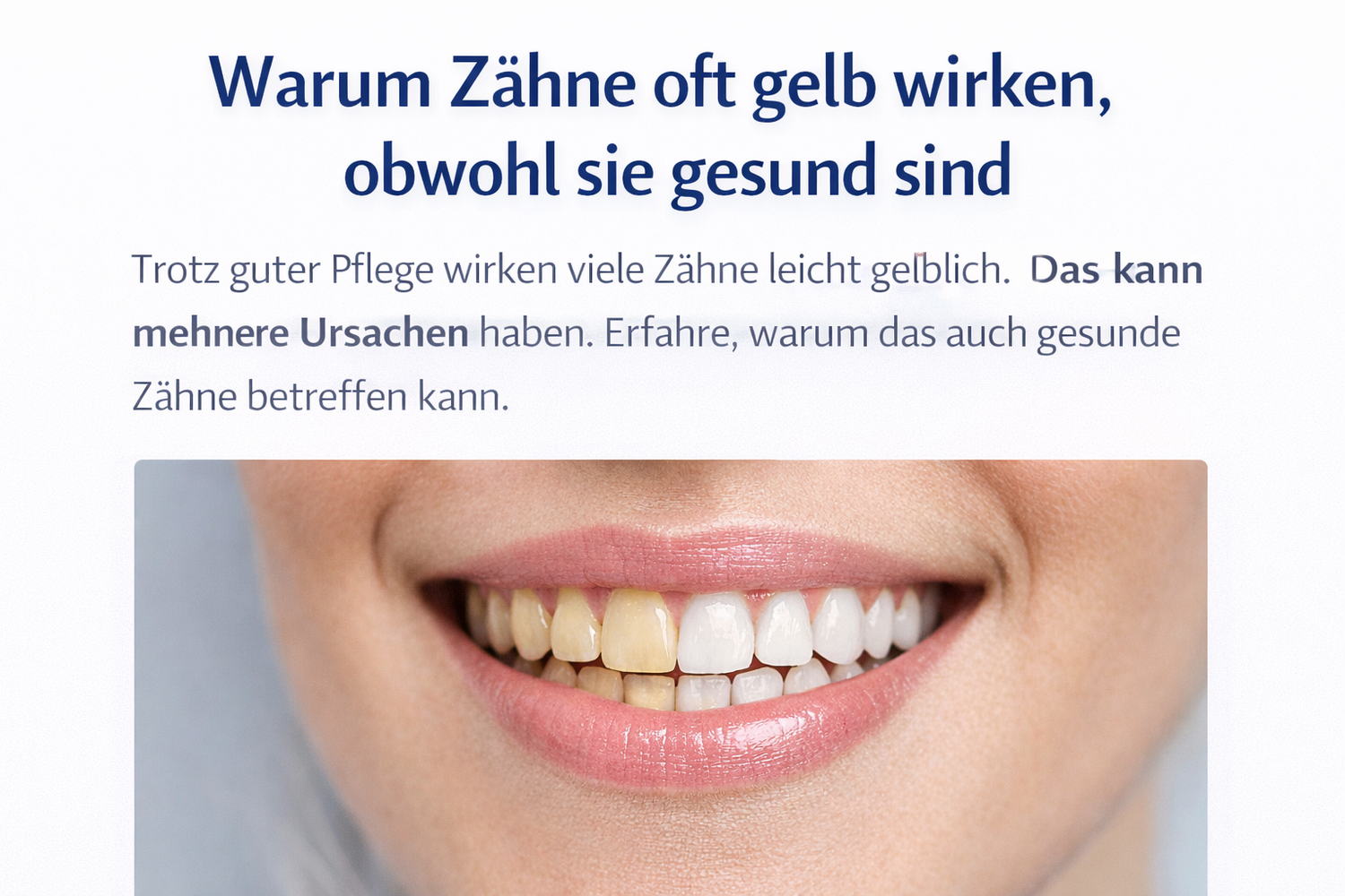 Warum Zähne gelb wirken, obwohl sie gesund sind | Ursachen & Lösung